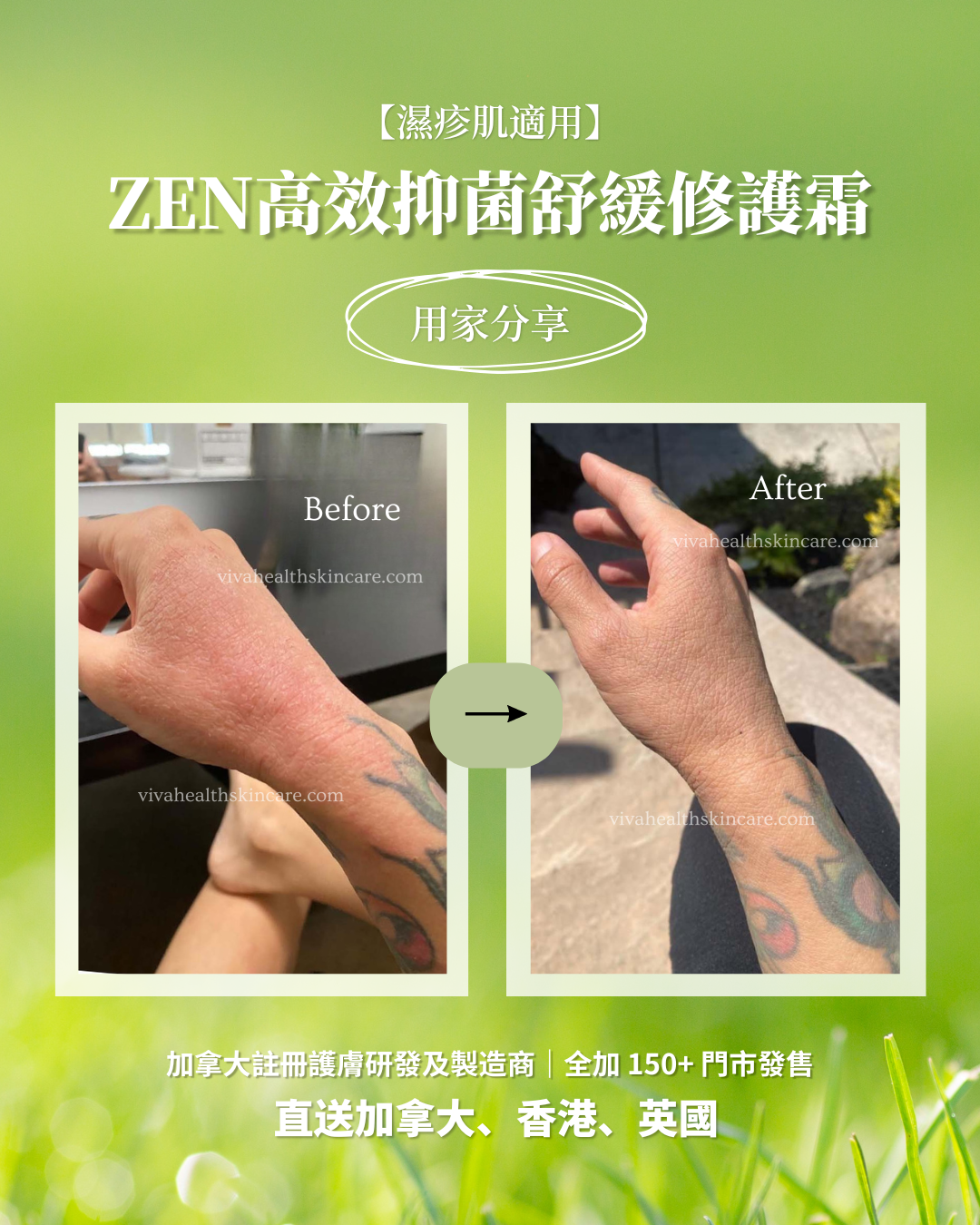 【濕疹肌適用】Zen高效抑菌舒緩修護霜